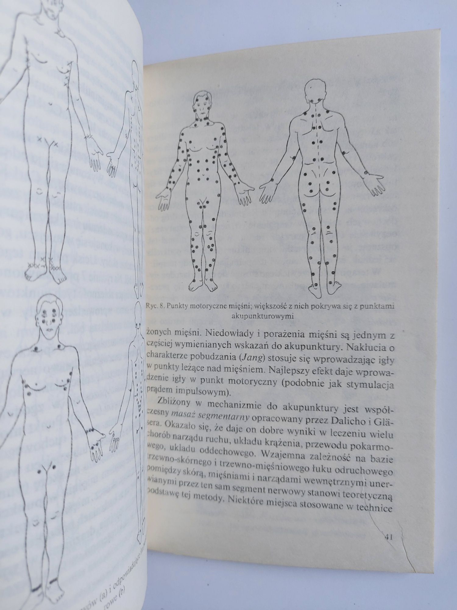 Bp biblioteka problemów - Akupunktura - Maciej Borzęcki