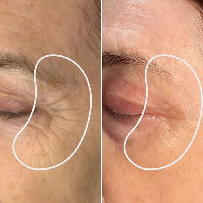 Косметолог- эстетист ,Теремки ,Голосеевский р-н. Выезд на дом .