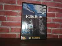 Retina Rehab Bodyboard No Friends DVD R2