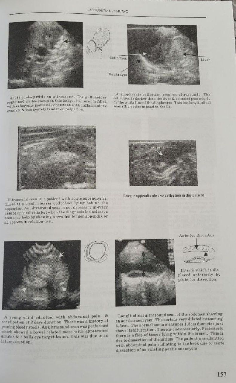 Diagnostic Radiology / Діагностика в Радіології. N. Pilipenko.