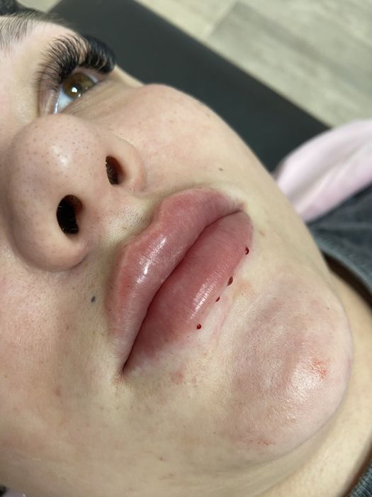 Аугментація обличчя