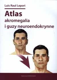 Luis Raul Lepori „Atlas akromegalia i guzy neuroendokrynne”