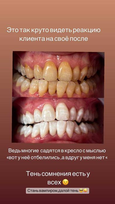 Косметичний бізнес / Франшиза відбілювання зубів Smile LAB