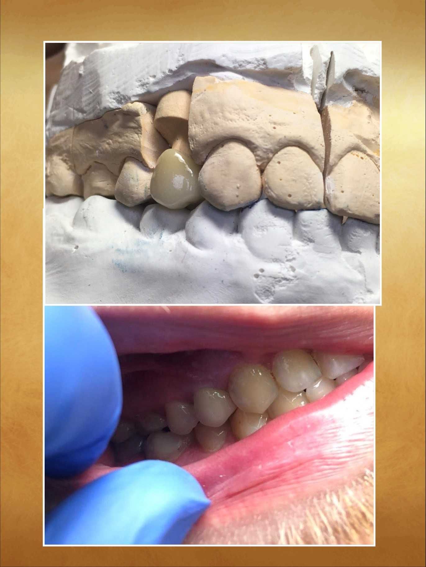 Зубной Техник ищу Стоматолога для сотрудничества