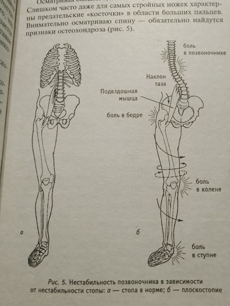 Книга по лікуванню та профілактиці остеохондрозу.