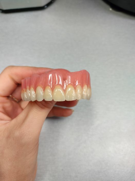 Ekspresowa Naprawa protez zębowych Opole centrum