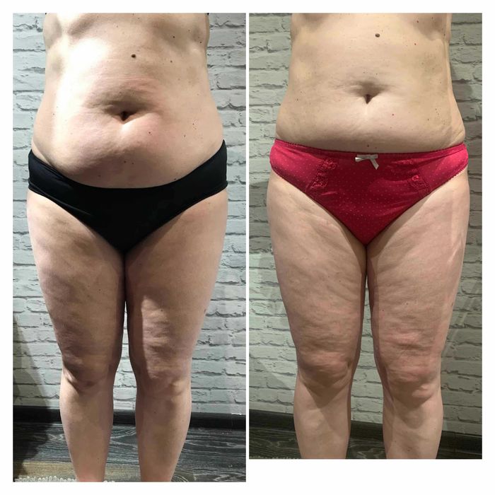 Масаж/Депіляція воском/Апаратний масаж