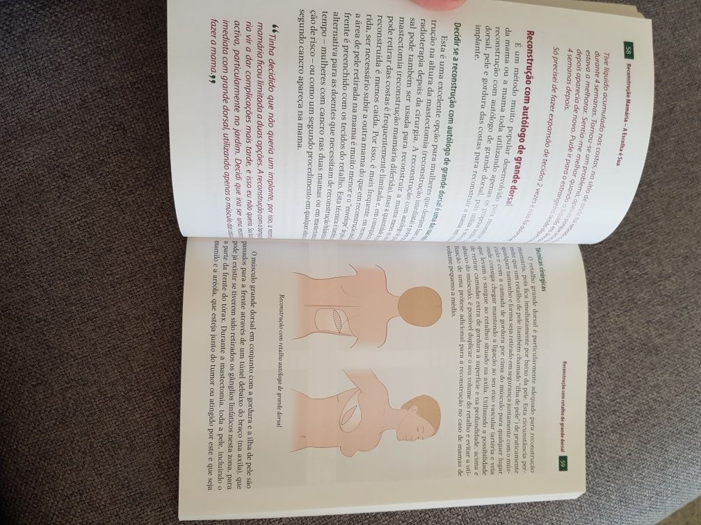 Livro "Reconstrução mamária - a escolha é sua" LIDEL
