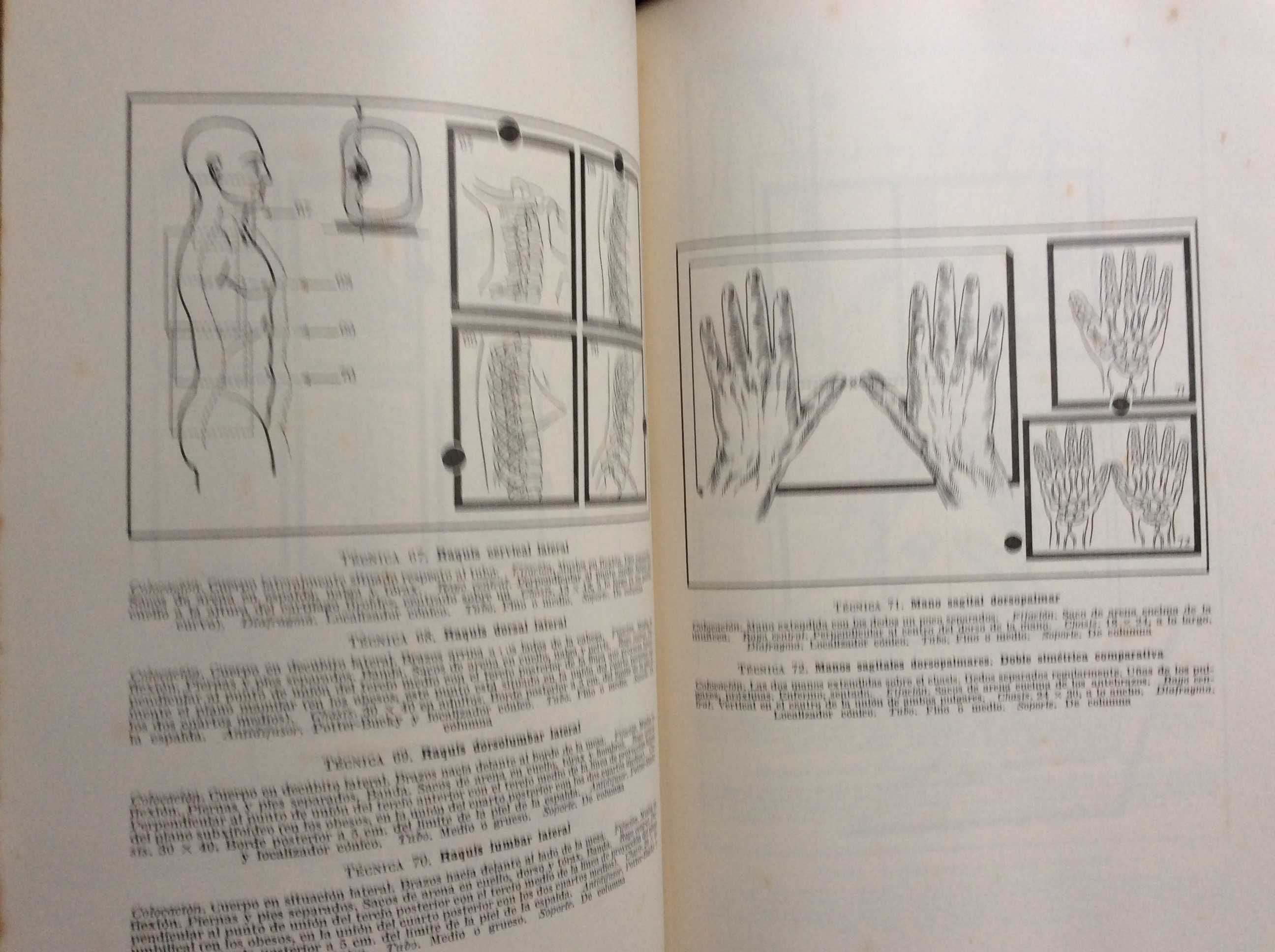 Técnica de la exploración roentgenoscópica y roentgenográfica , 1944