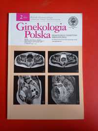 Ginekologia Polska, nr 2/2012, luty 2012