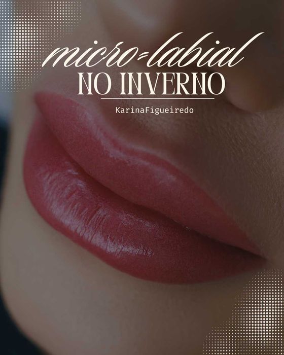 Remoçao de pigmentos a Laser