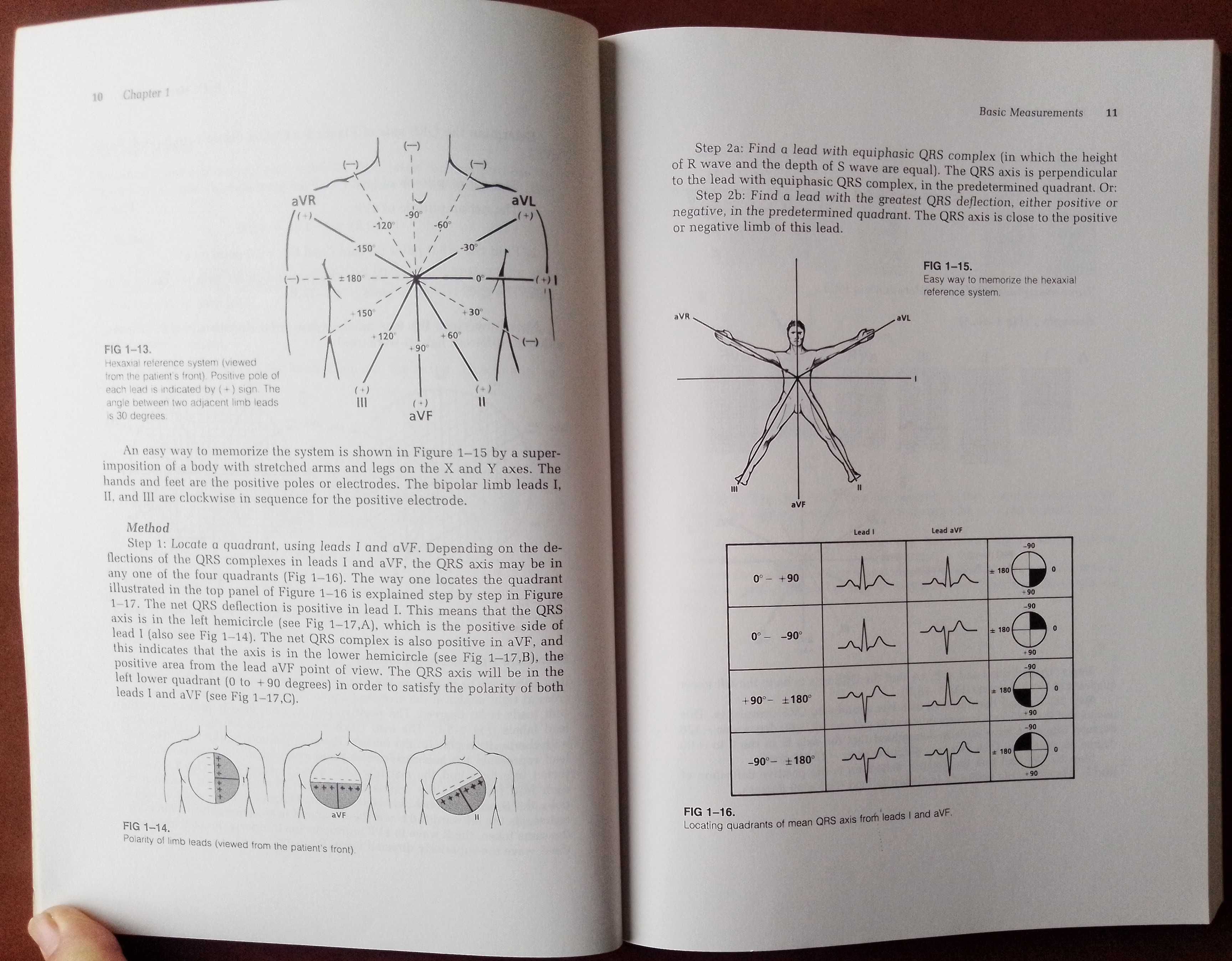 How to read Pediatric ECGs
