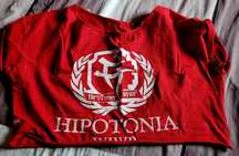 Top cropp hipotonia