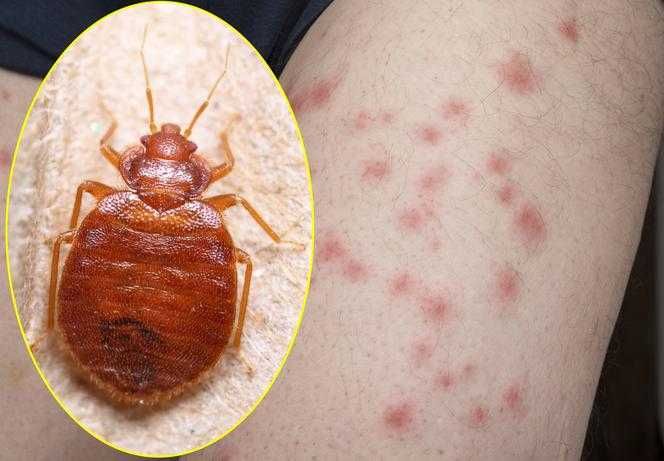 Usuwanie Pluskiew Pluskwy Prusaków Dezynfekcja Dezynsekcja Ozonowanie
