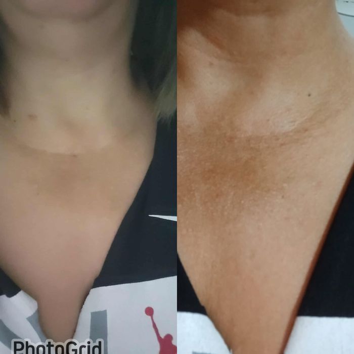 Tratamento Estético - depilação etc