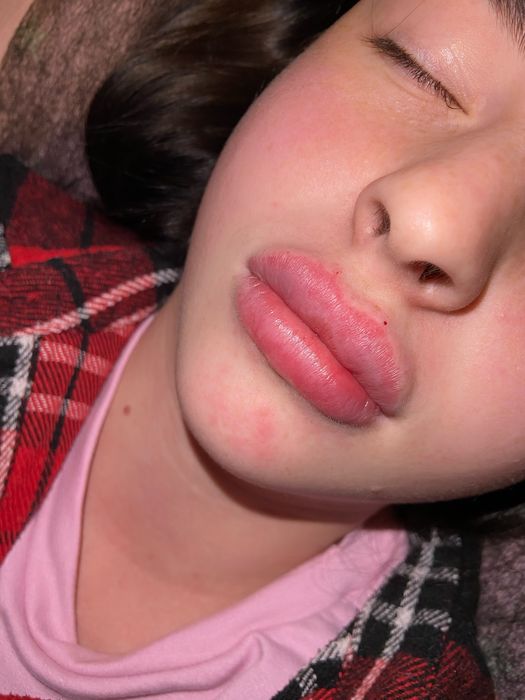 Аугментація обличчя