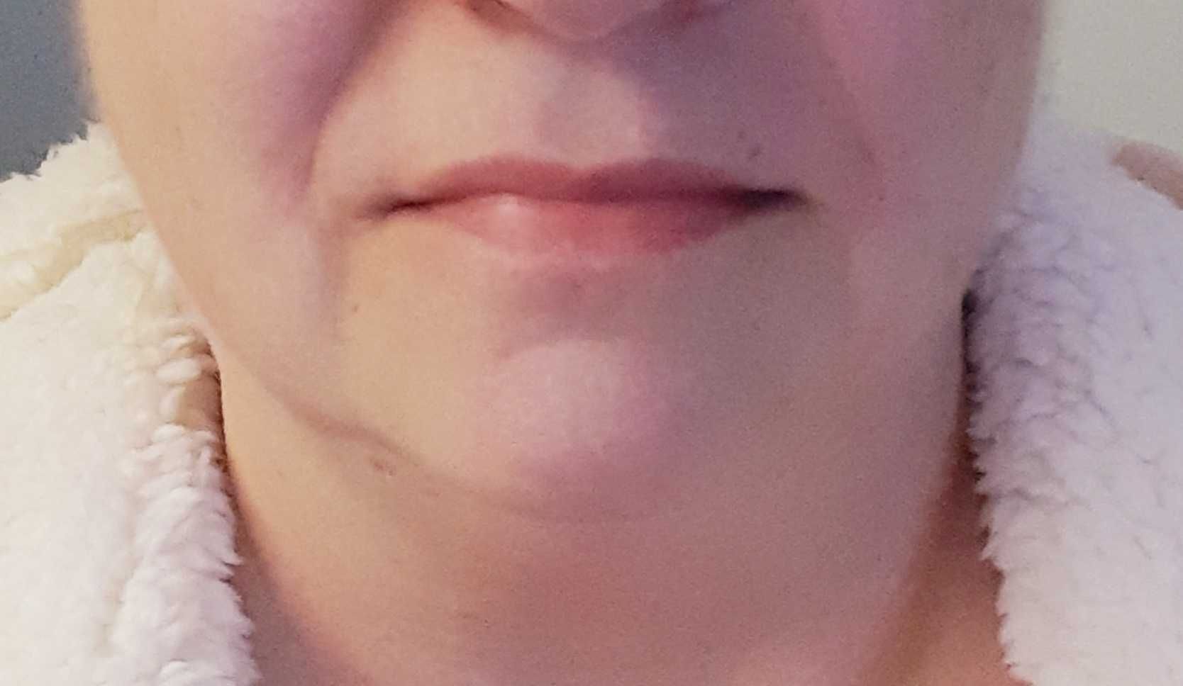 Liftingujący masażer do twarzy V-FACE,  HY-18