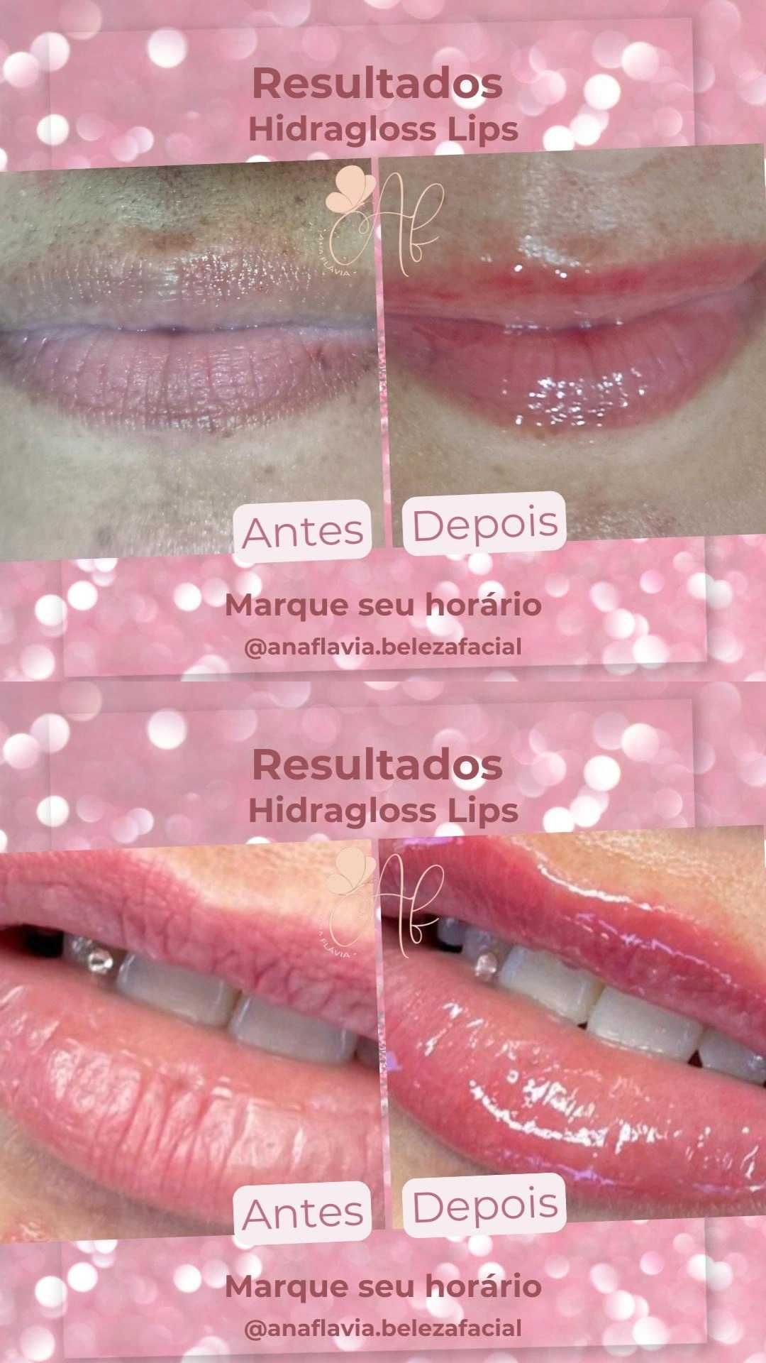 Estética Facial Ana Flávia Martins
