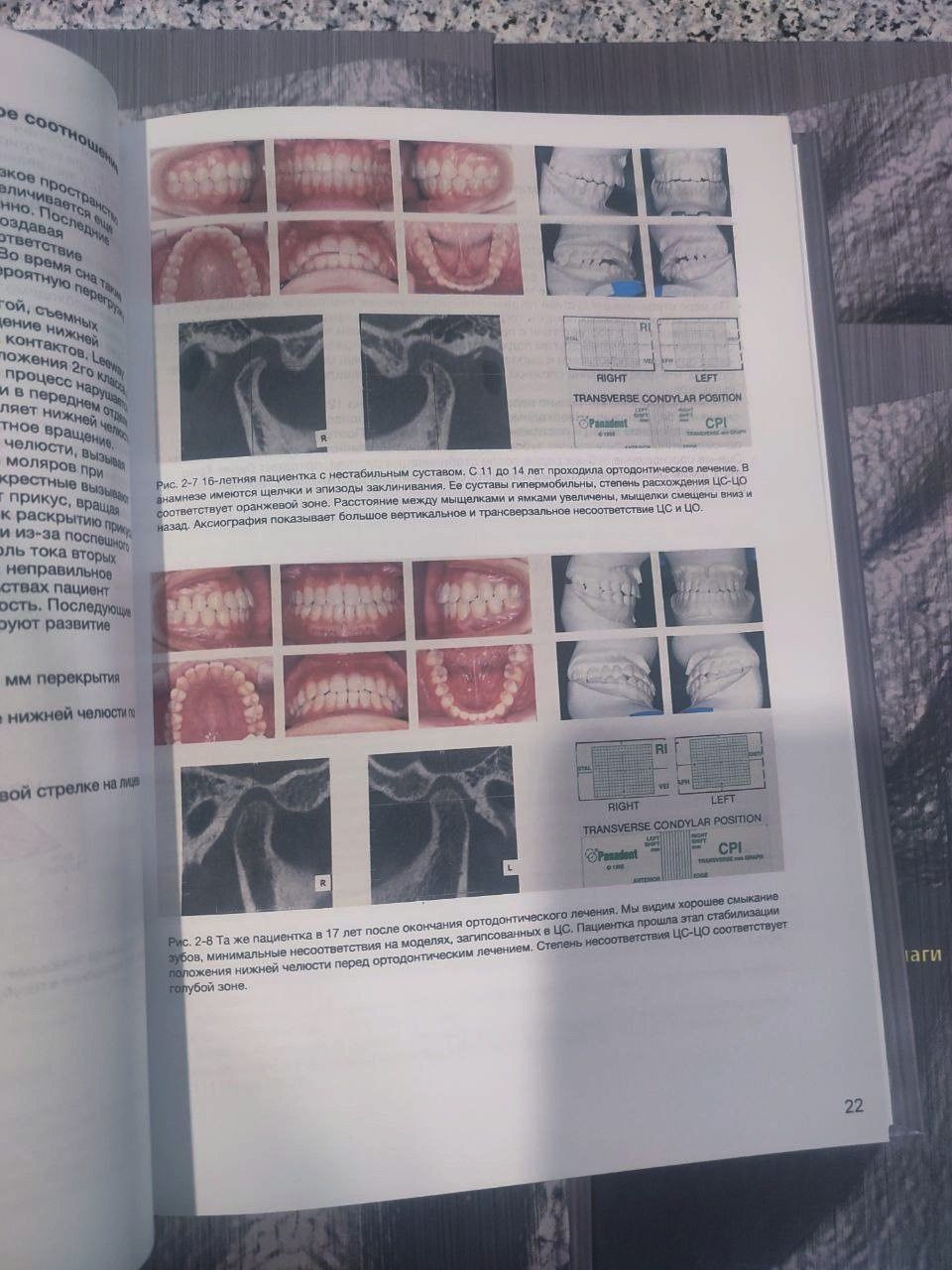 Ортодонтия.  Перевод. Эксклюзивный учебник. Стоматология