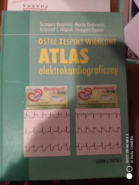 Atlas elektrokardiografii Ostre zespoły wiencowe