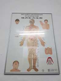 3 Pôster's de Acupuntura /Meridianos