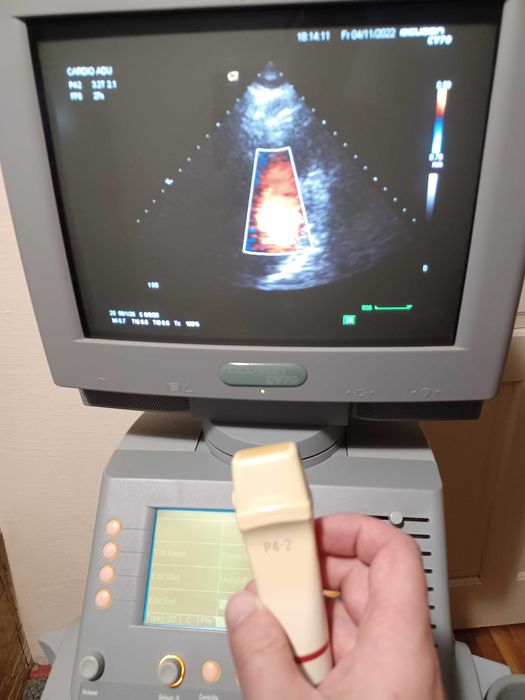 УЗД УЗИ апарат Siemens Acuson CV70 (кардіологічний), обмін