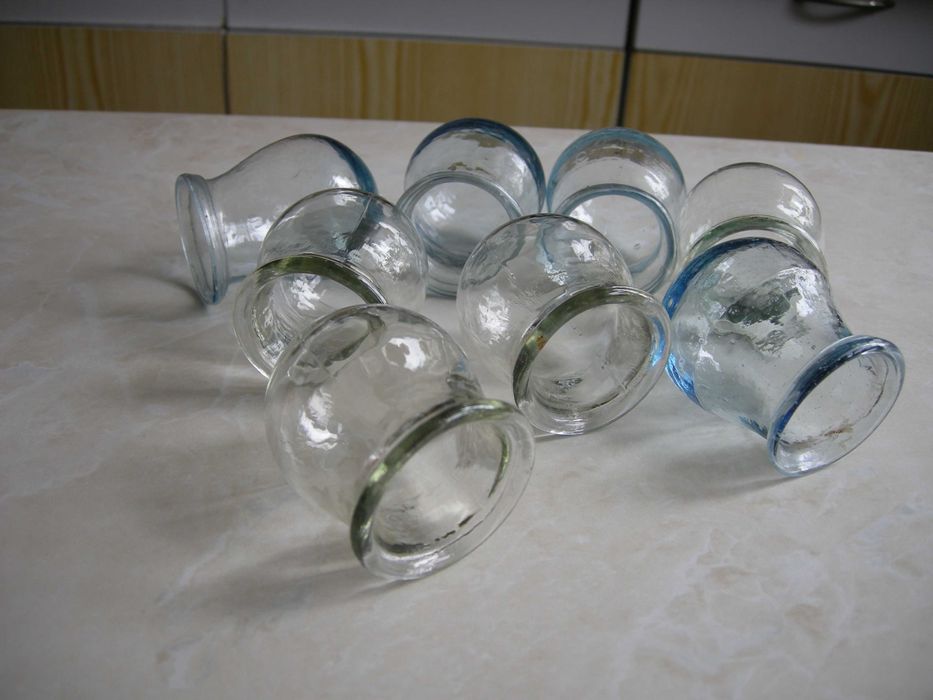 Медицинские стеклянные банки для вакуумного массажа, СССР