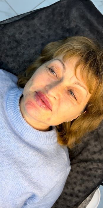 Потрібні моделі на збільшення губ