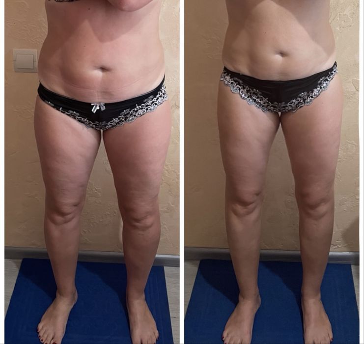 Массаж эпиляция. Только для женщин. Улица Гурова 17 ,салон Подиум