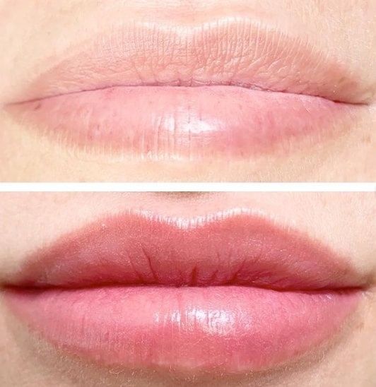 Hidra Lips / Bb lips