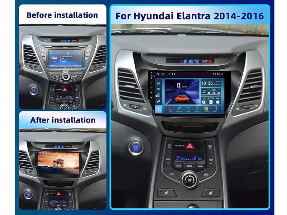 Radio samochodowe Android Hyundai Elantra (9") 2014.-2016