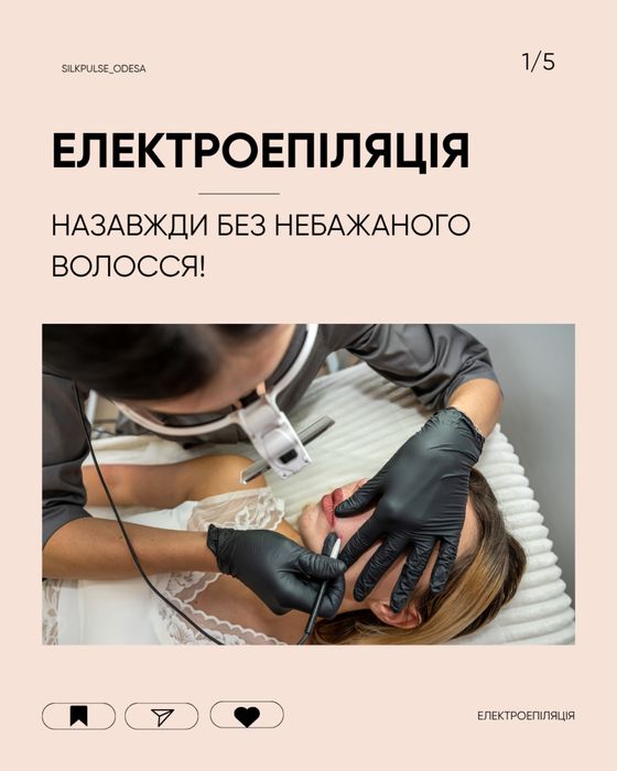 Електроепіляція, электроэпиляция