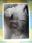 DVD Placebo (Original)