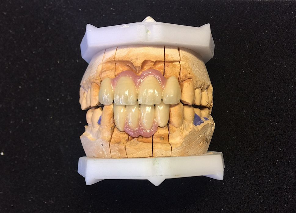 Зубной техник ( зуботехнические услуги)