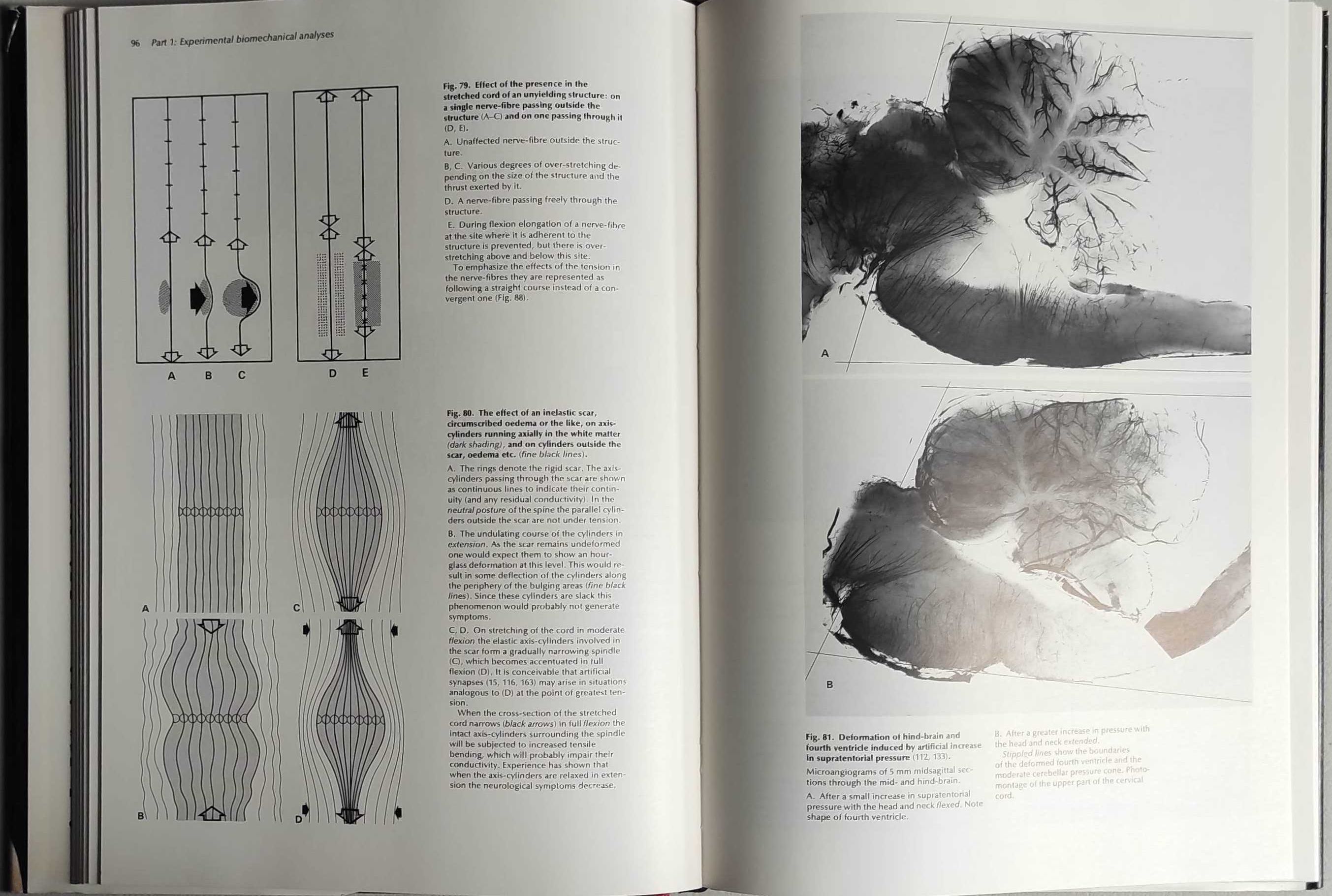 Livro - Adverse Mechanical Tension in the Central Nervous System