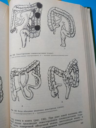 Хирургические болезни учебная литература