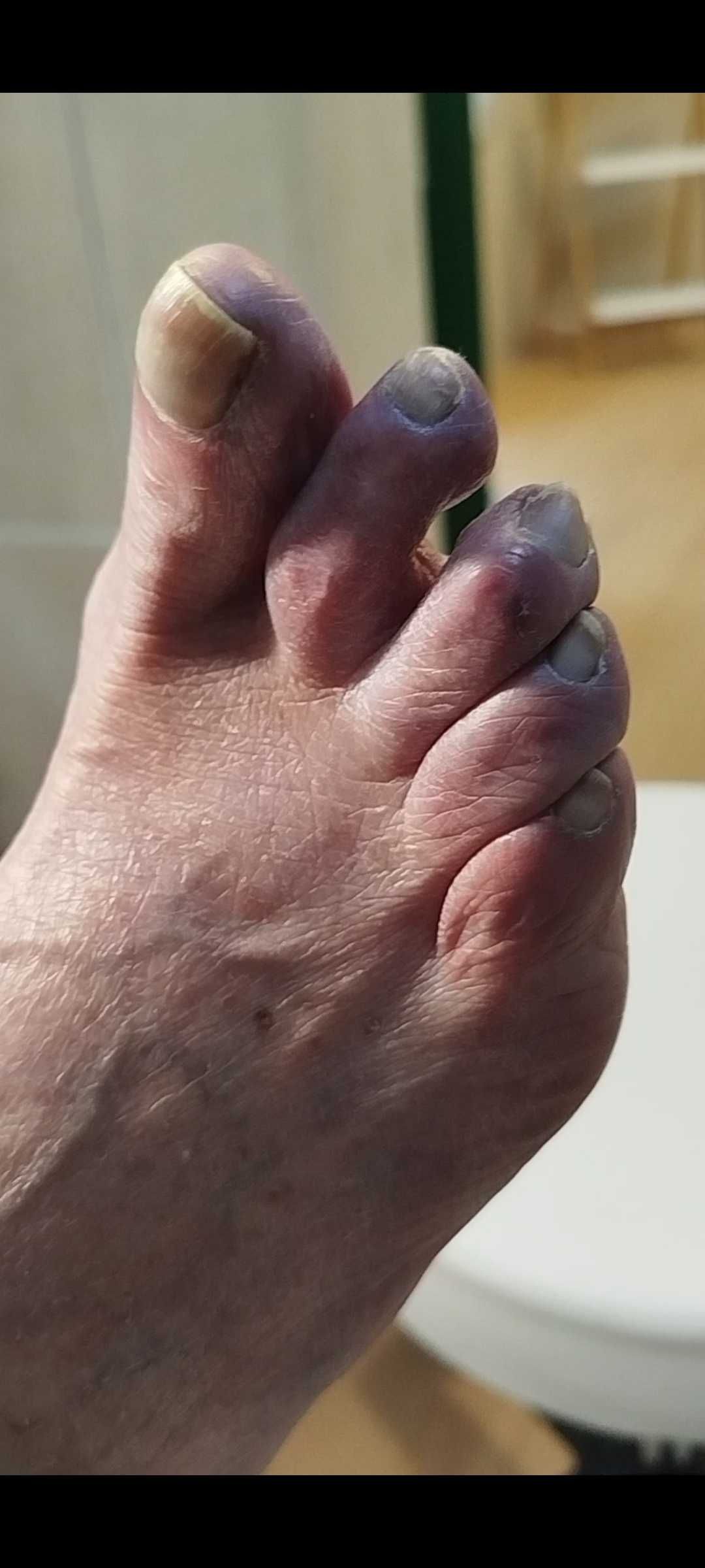 Pedicure medical