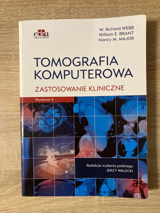Tomografia Komputerowa Zastosowanie Kliniczne