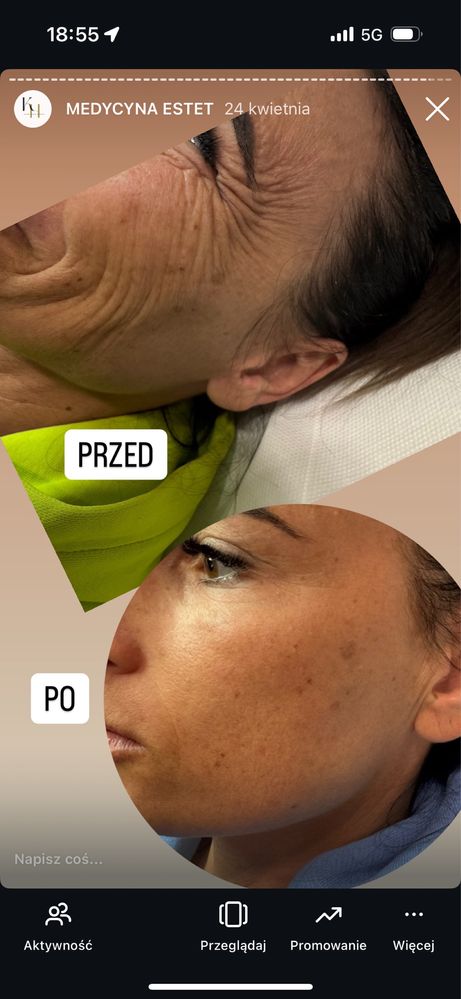 Medycyna estetyczna,przedłużanie włosów.