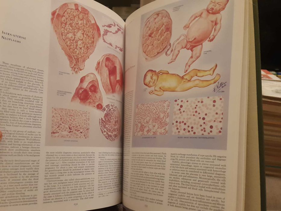 The Ciba Collection of Medical Illustration - 2. Reproductive System