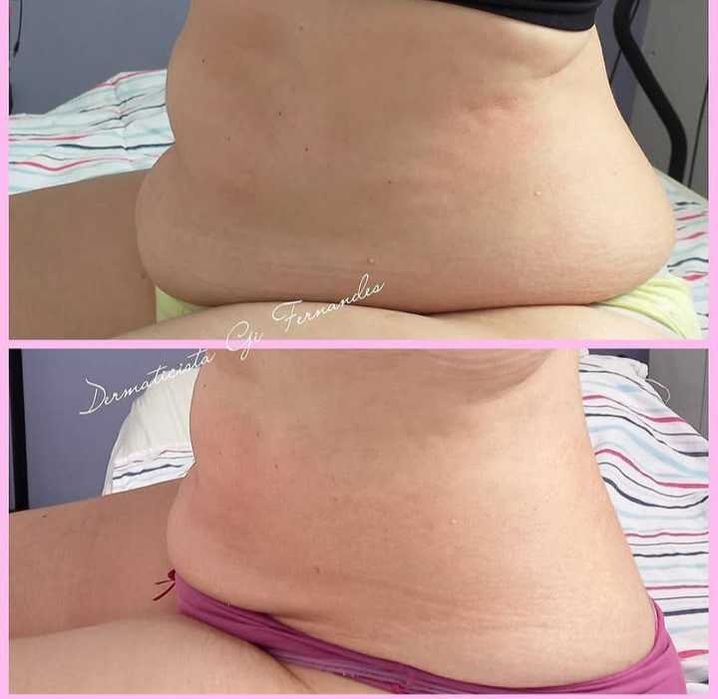 Estética Facial e Corporal Avançada/ EXCLUSIVO para MULHERES