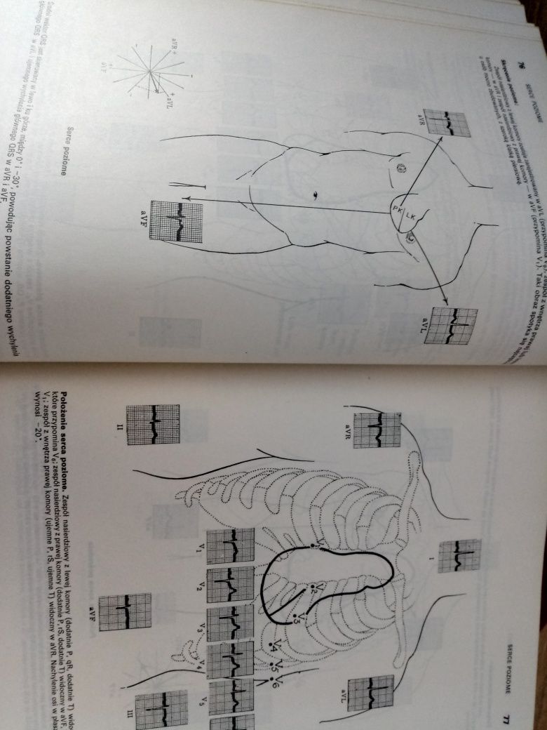 Podstawy elektrokardiologii klinicznej.M .J. Goldman