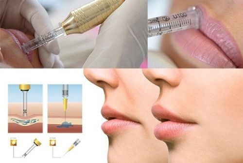 HYALURON PEN Caneta Pressurizada Intradermoterapia