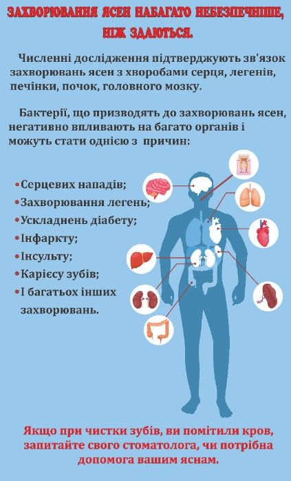 Плакати. Стенди, санбюлетні, поліграфія