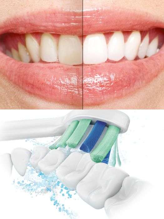 Звукова СУПЕР Зубна щітка навіть для Брекетів Philips HX6803/04 ШАРА!