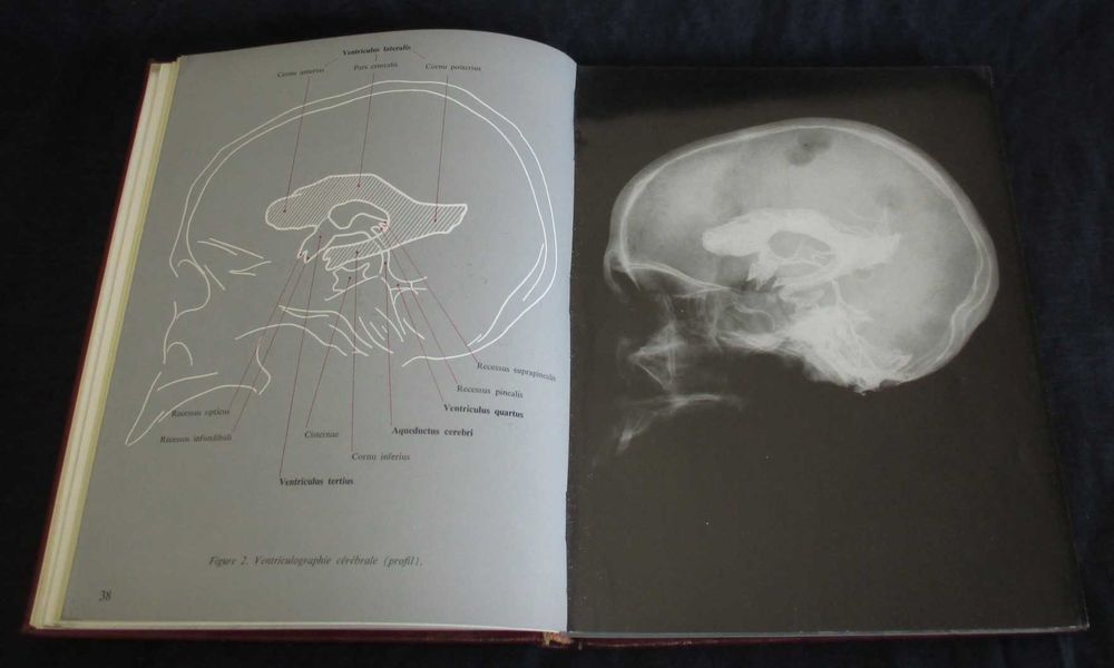 Livro Cava Vitalia G. Van Der Schueren 1959