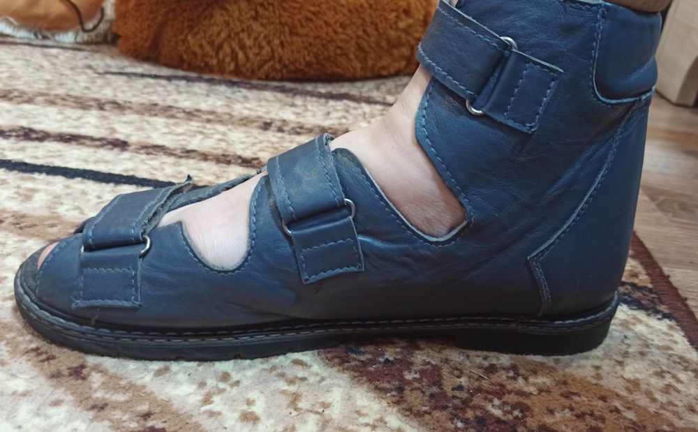 Ортопедичне взуття.