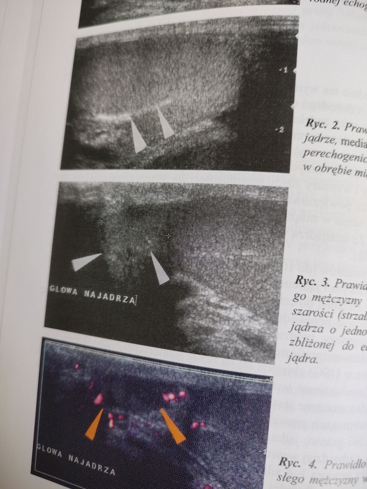 Diagnostyka ultrasonograficzna narządów moszny