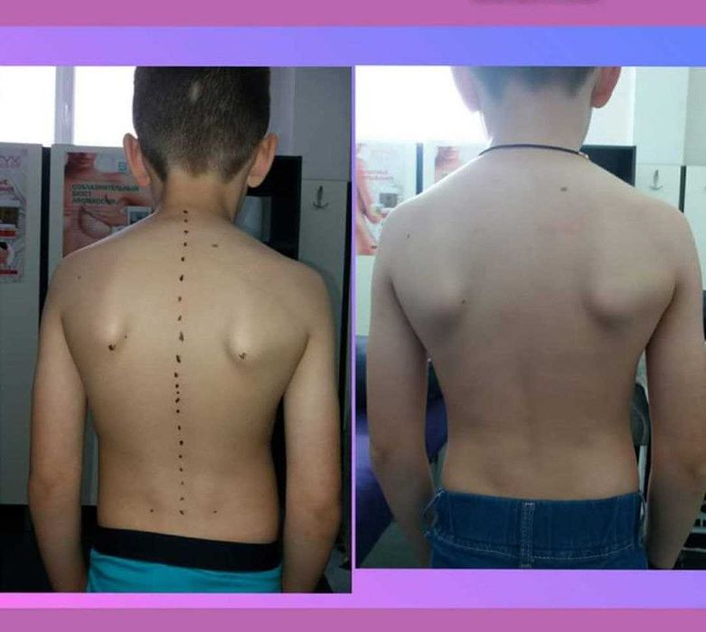 Лікувальний терапевтичний масаж для дітей і дорослих