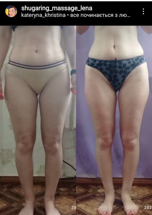 Масаж вакумний(апаратний) Антицел-тний; Шугаринг;Титова.